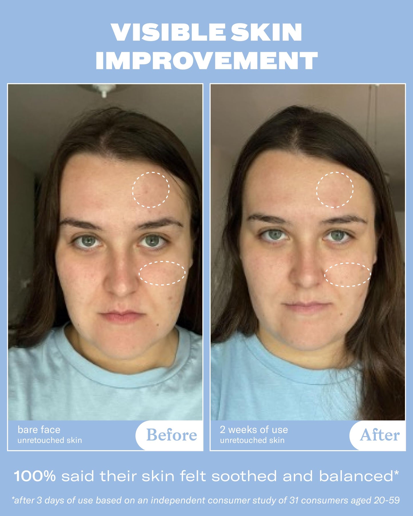 Then I Met You Renewing Rich Beauty Cream, Deep Hydration Korean Moisturizer with Quad Ginseng Complex, Fast Absorbing Vegan-Cruelty-Free Plant-Based Antioxidant, Alcohol Free Skincare for Exfoliated